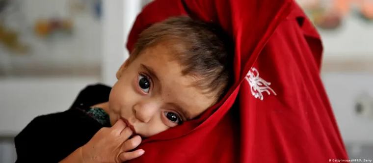 UNICEF Warns 4.9 Million Women and Children in Afghanistan Face Acute Malnutrition in 2026